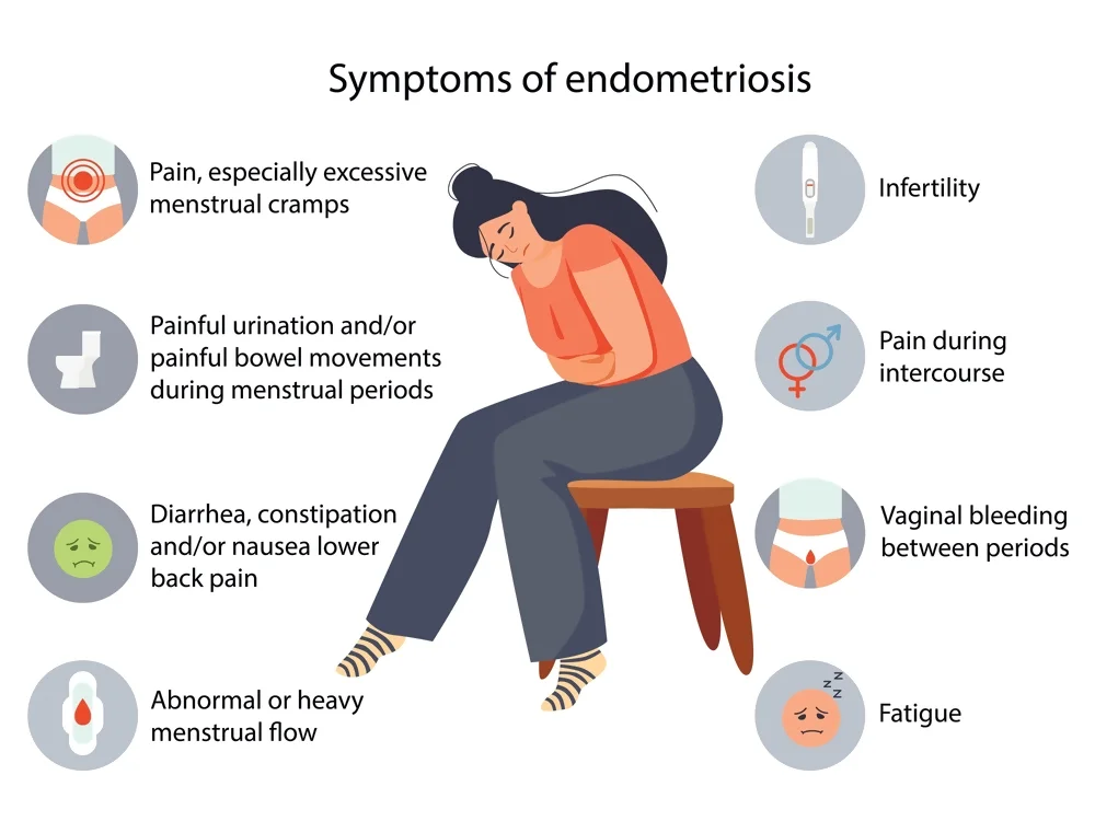 Symptoms of Endometriosis