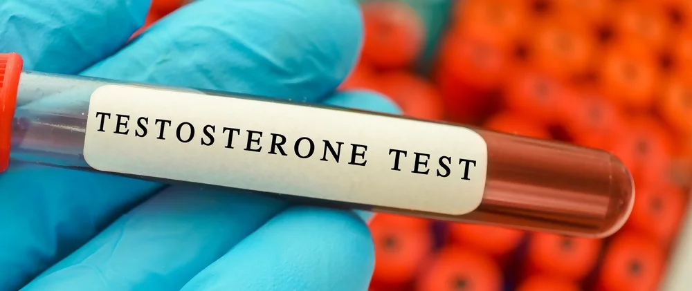 Tesosterone Test