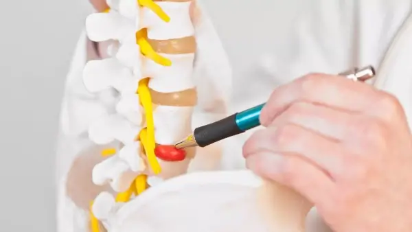 Osteopathic Solutions for Herniated Disc Issues