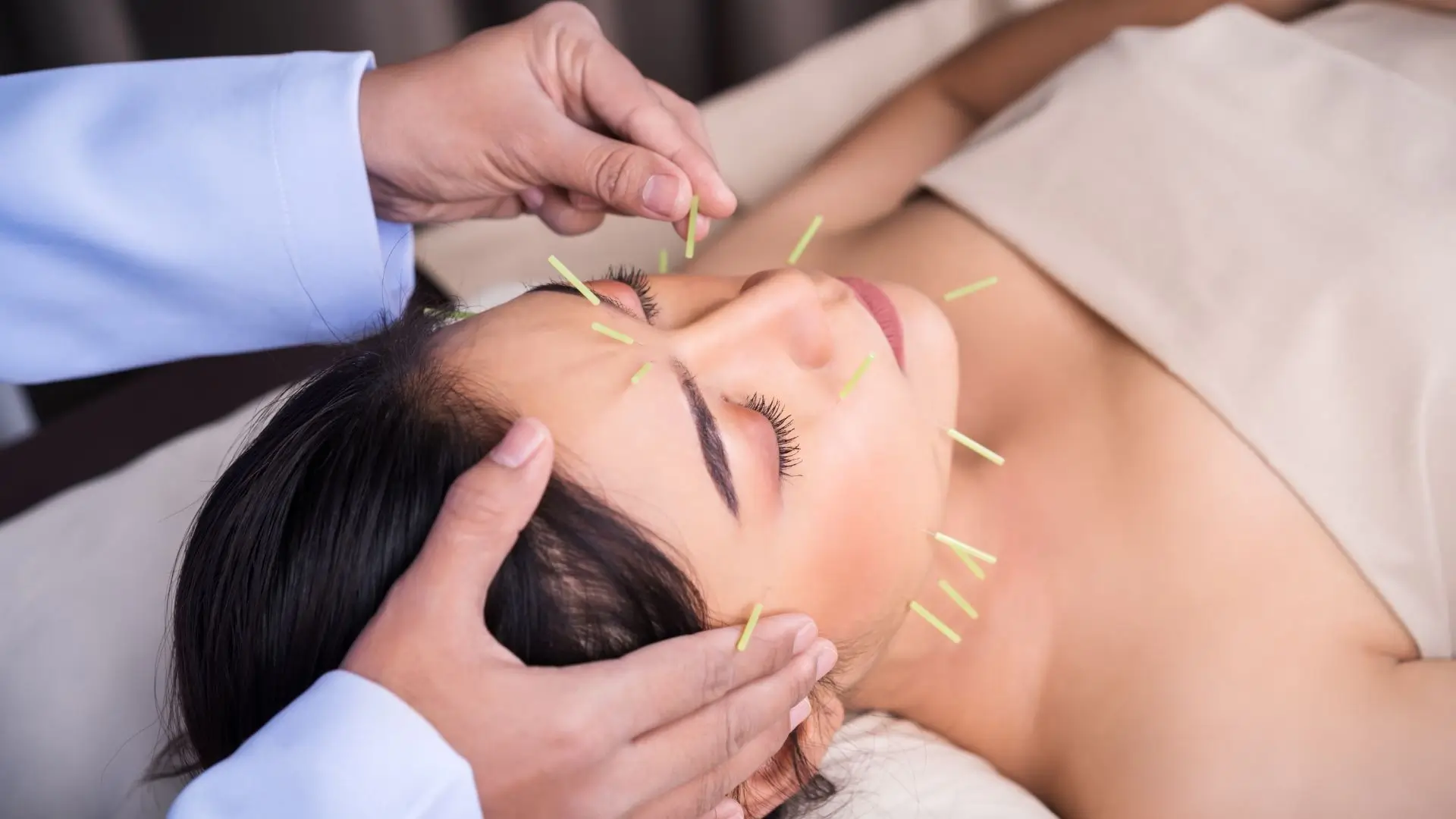 Cosmetic Acupuncture