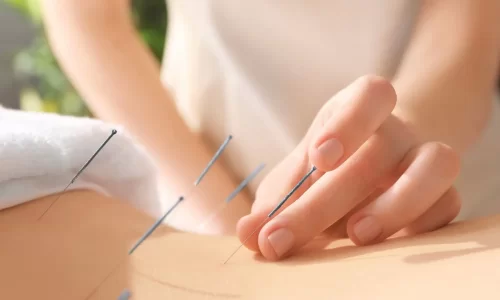 Acupuncture for Digestive Issues