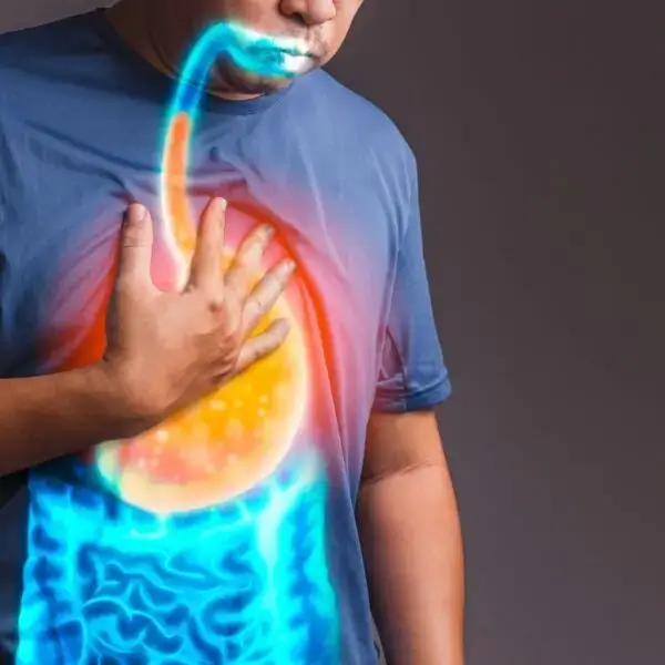 Gastroesophageal Reflux Disease (GERD), Gastrointestinal Disorders