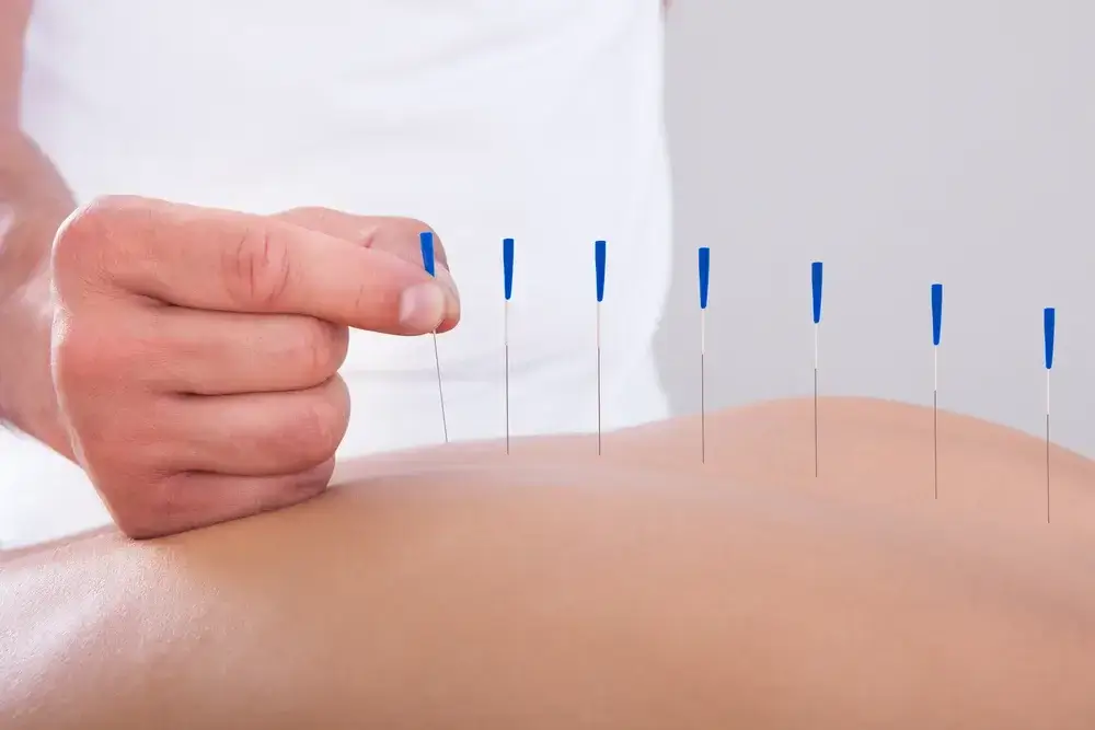 Acupuncture Treatment for Uterine Fibroid