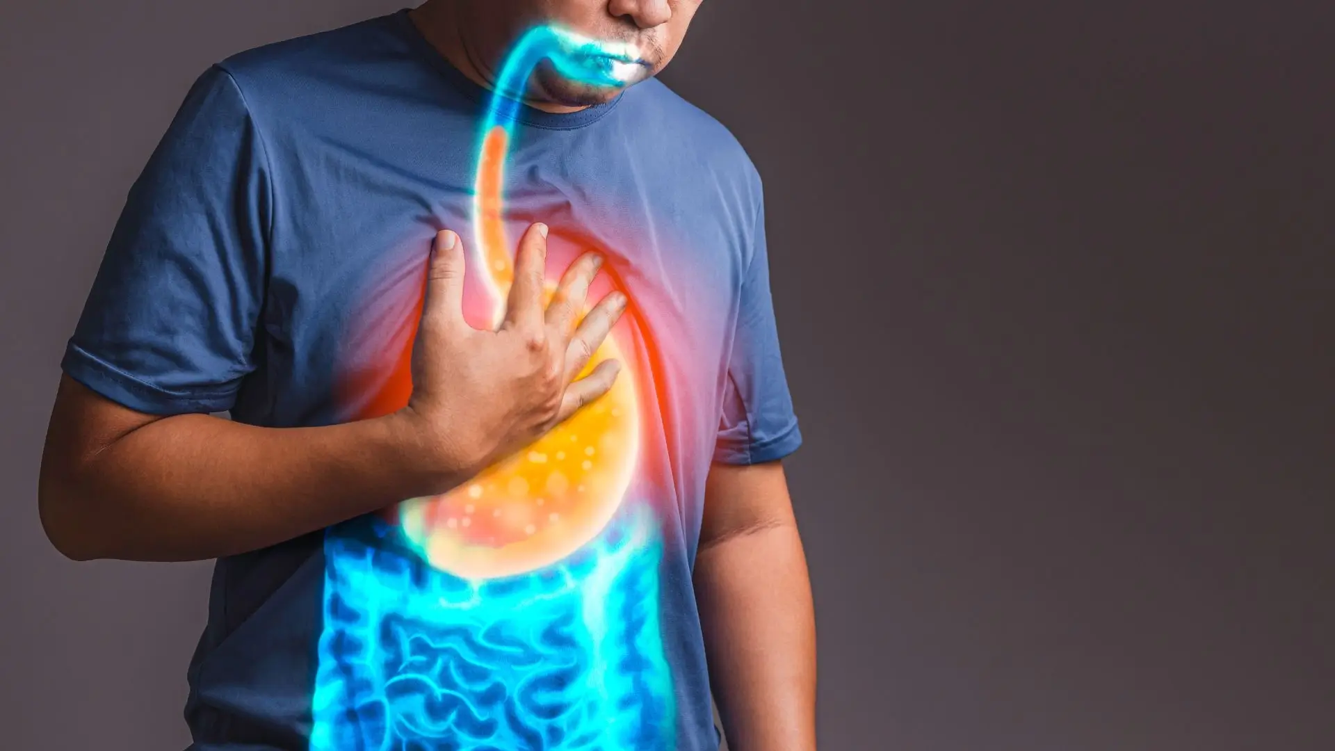 Gastroesophageal Reflux Disease (GERD), H.Pylori, Heartburn