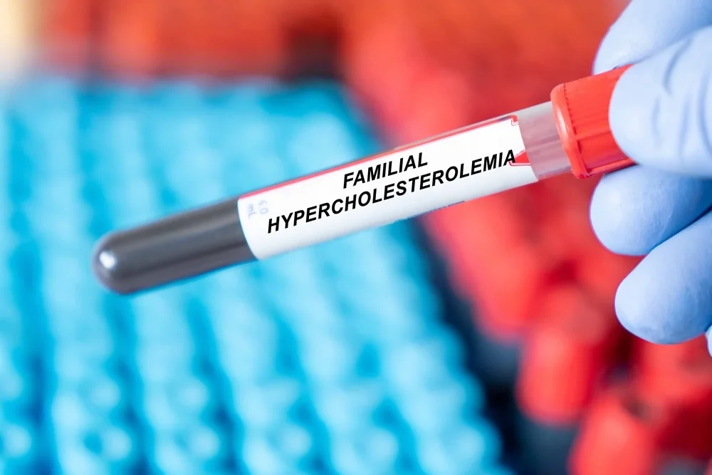 Naturopathic Considerations for High Cholesterol and Hypercholesterolemia #highcholesterol @highcholesterol