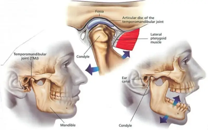 TMJ Symptoms 800x499 1