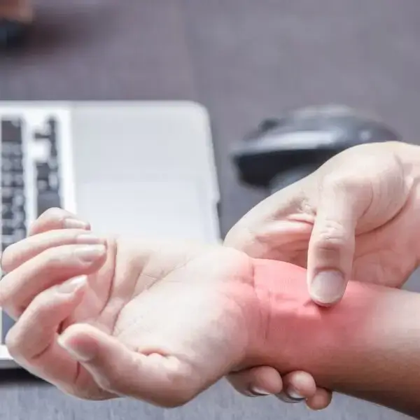 Carpal Tunnel Syndrome