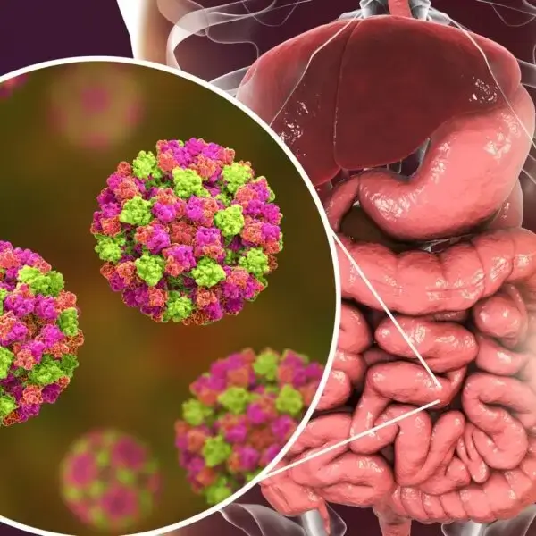 Gastroenteritis, Gastrointestinal Disorders