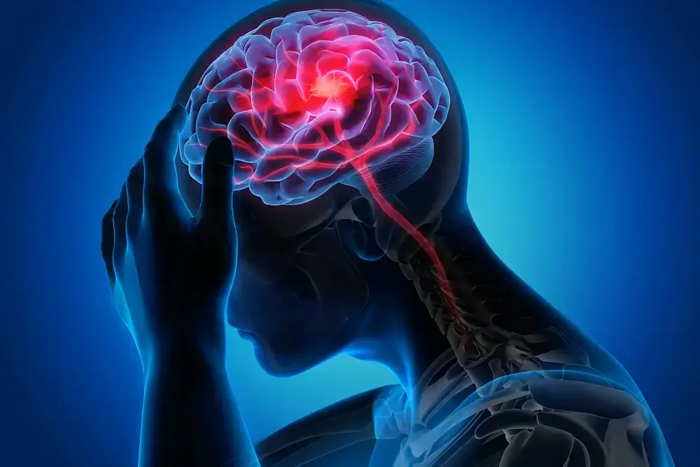 Naturopath for Headaches