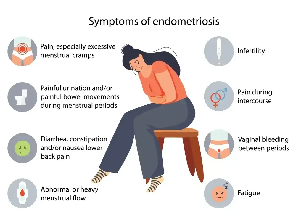 Acupuncture for Endometriosis