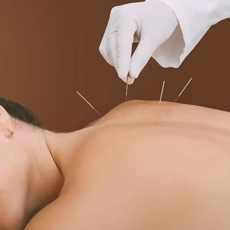 Acupuncture Clinic