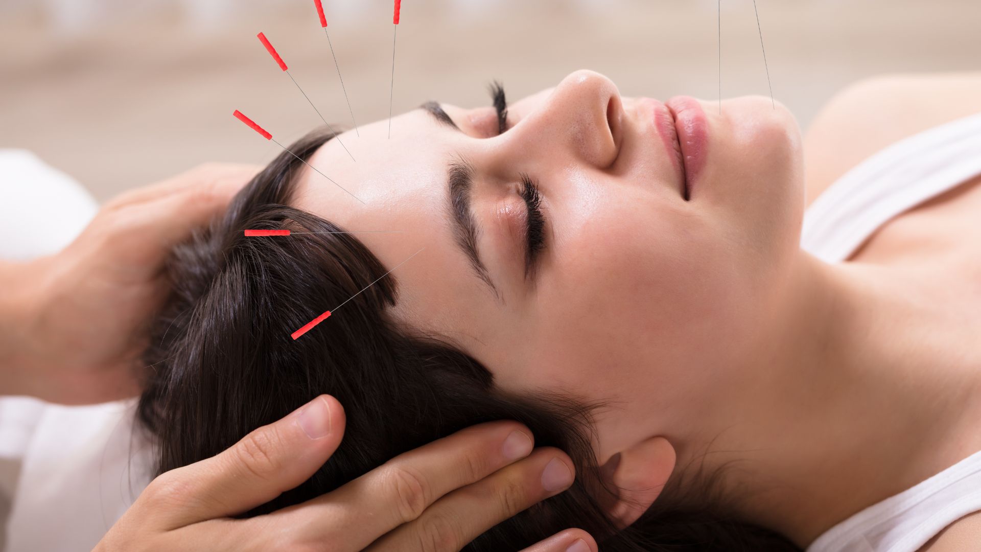 Who Can Benefit From Acupuncture?