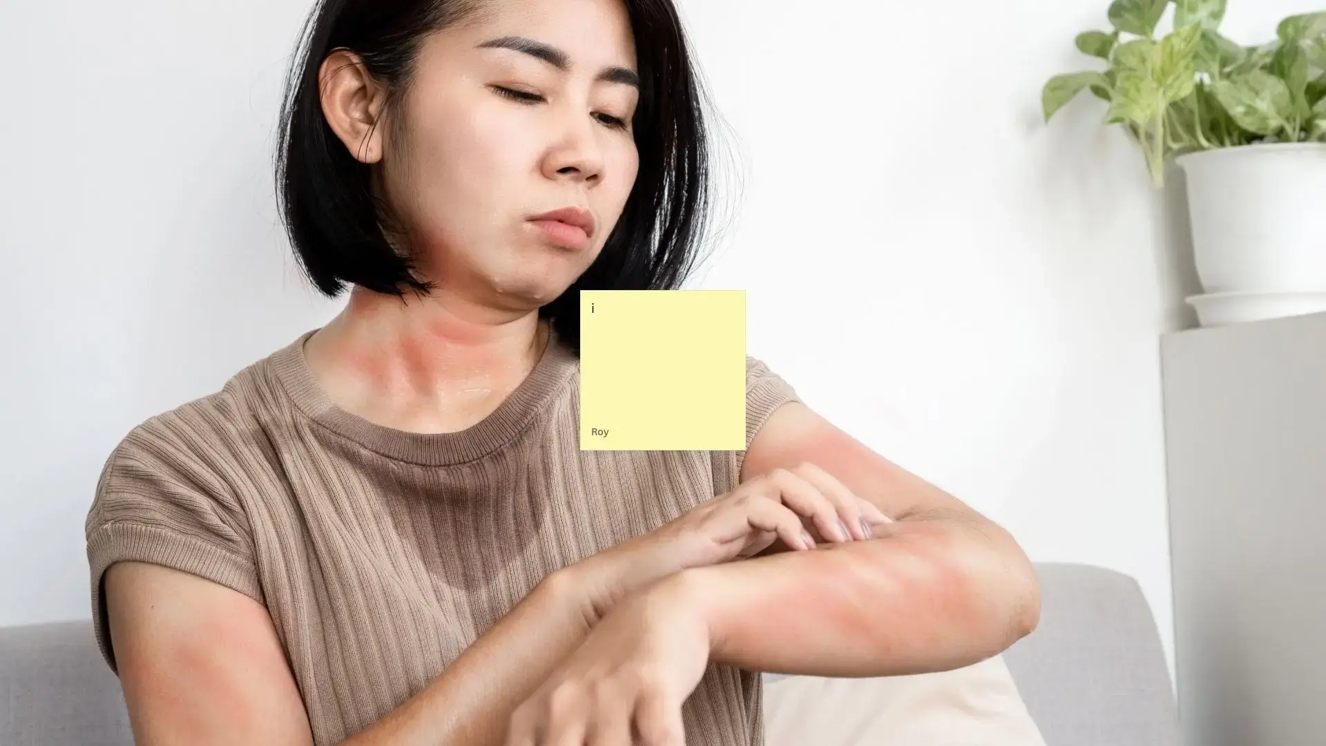 Hives, Skin Rash