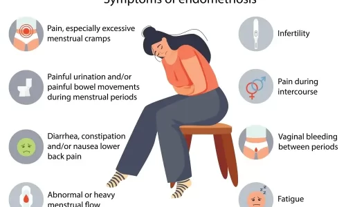 Endometriosis