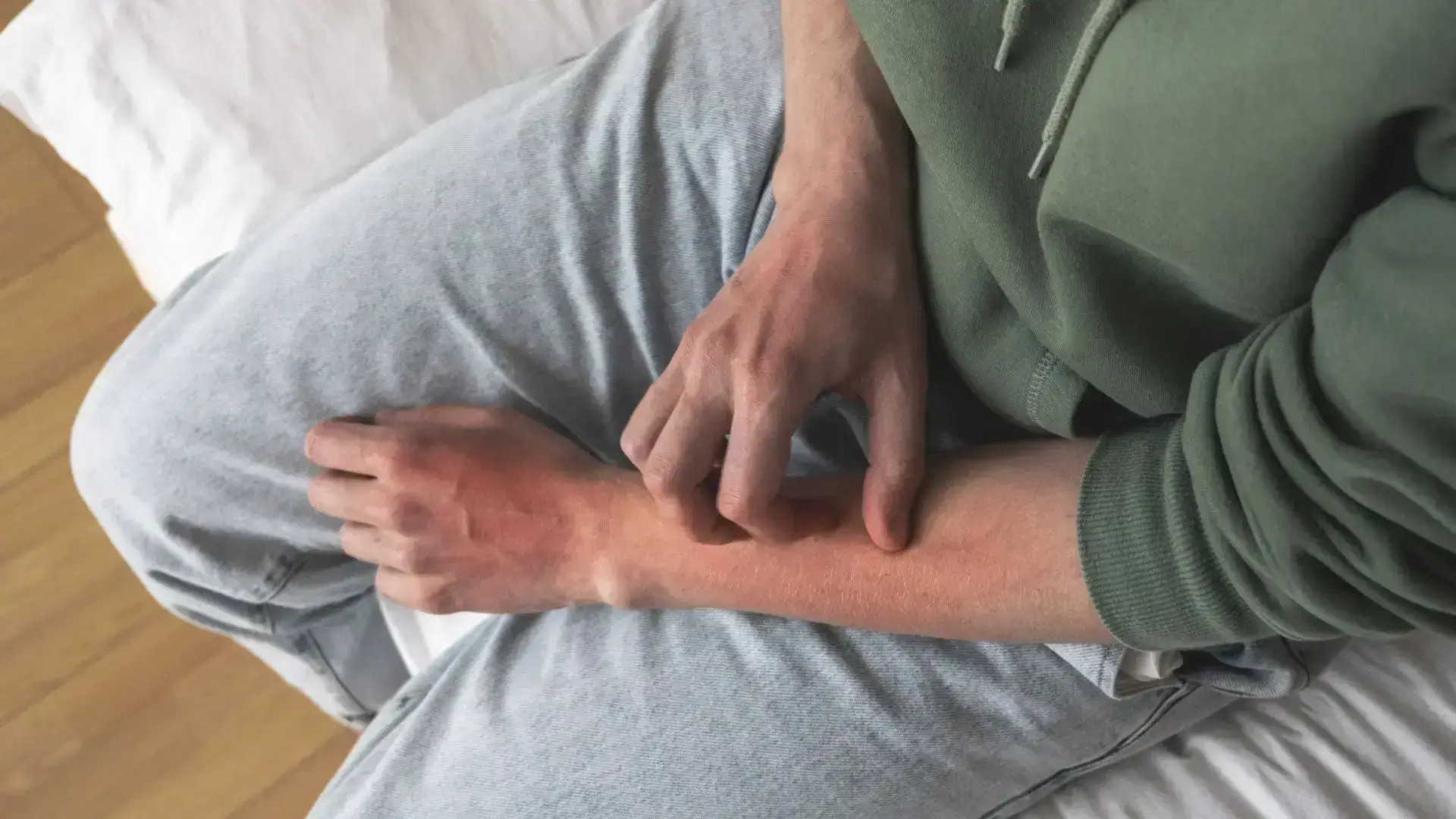 Hypersensitivity Disorders – Allergies