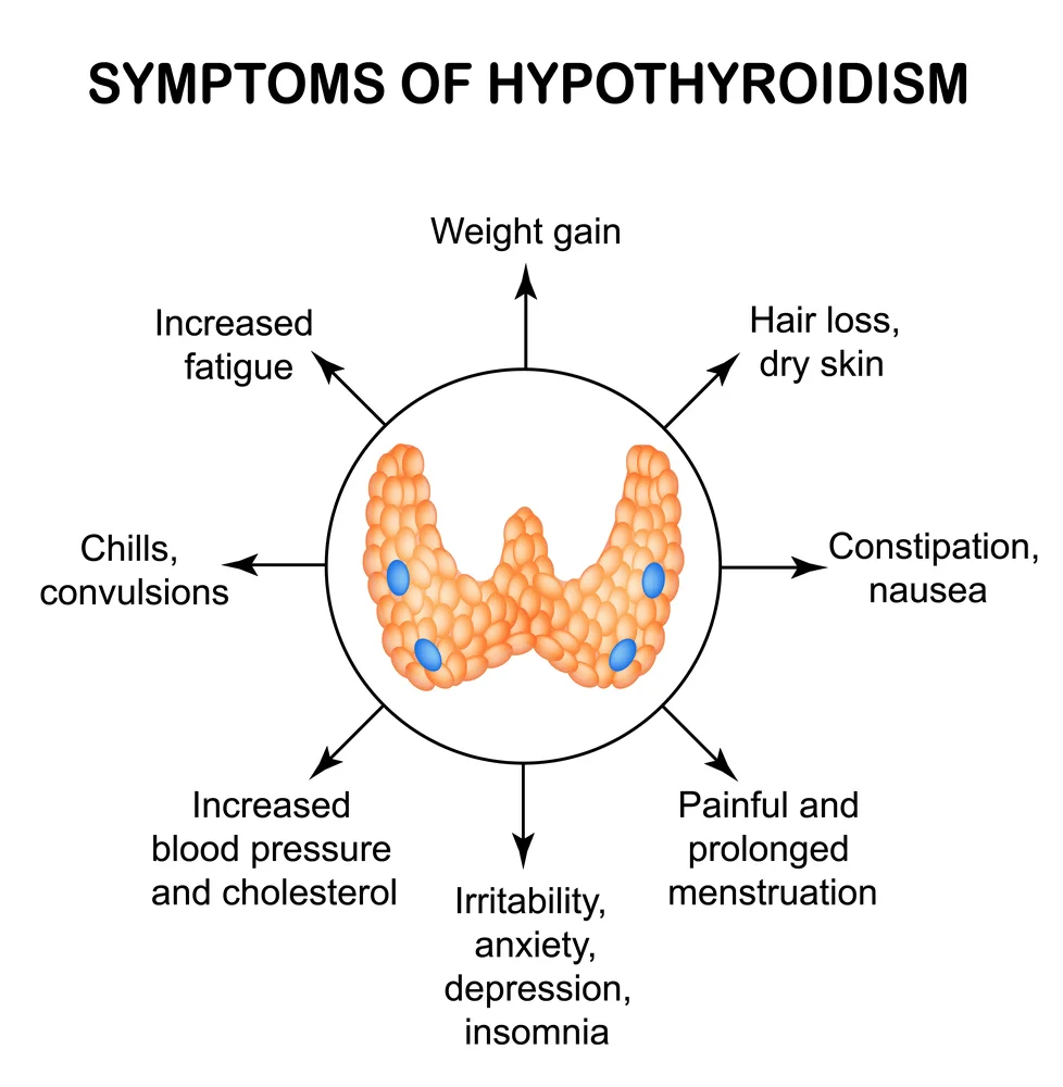 Manifestations of an Underactive Thyroid as Observed by a Naturopath