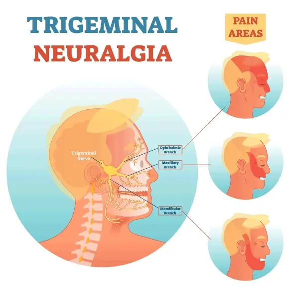 Osteopathic Perspective on Trigeminal Neuralgia: TMJ Pain, Termed as the "Most Severe Pain"