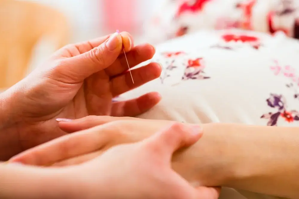 Acupuncture for Morning Sickness