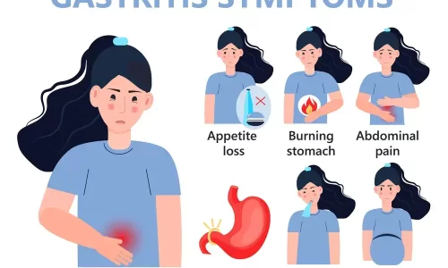 Acupuncture for Gastritis