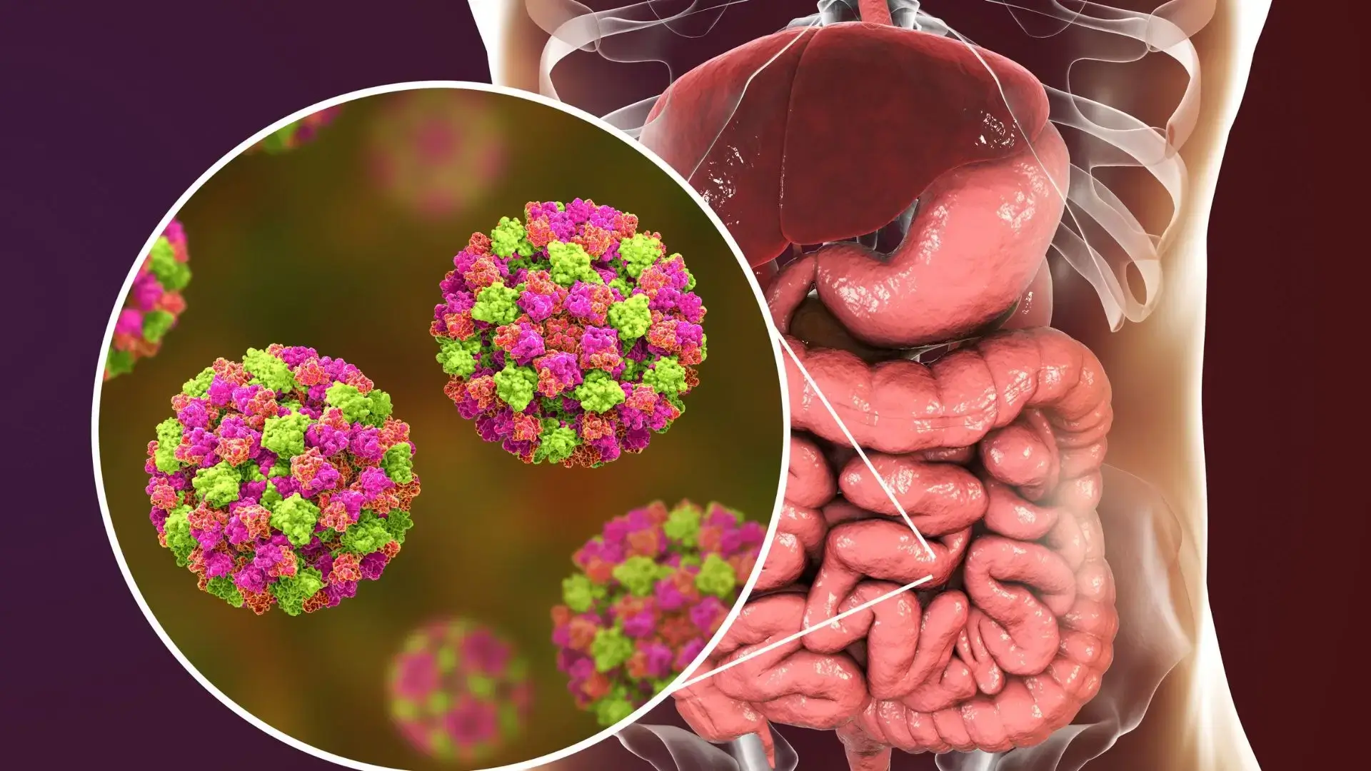 Gastroenteritis, Gastrointestinal Disorders