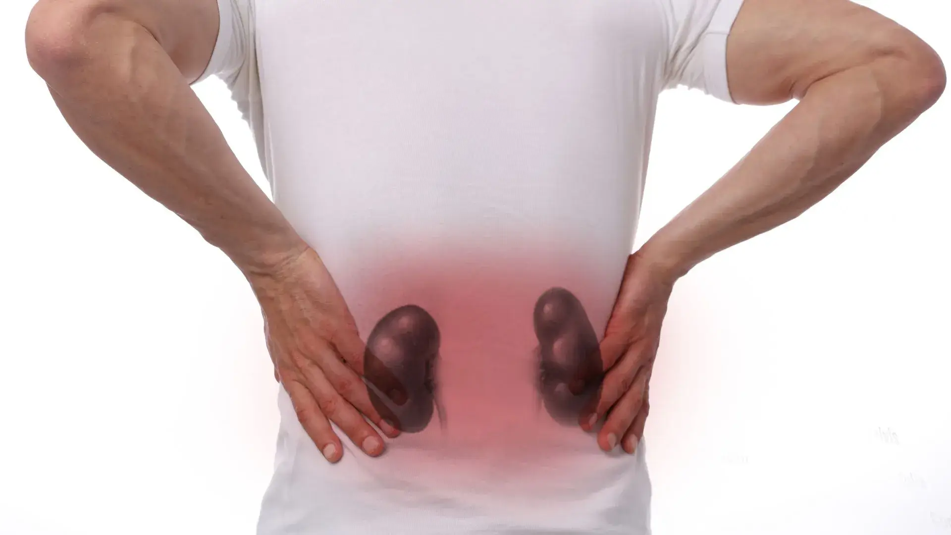 Pyelonephritis