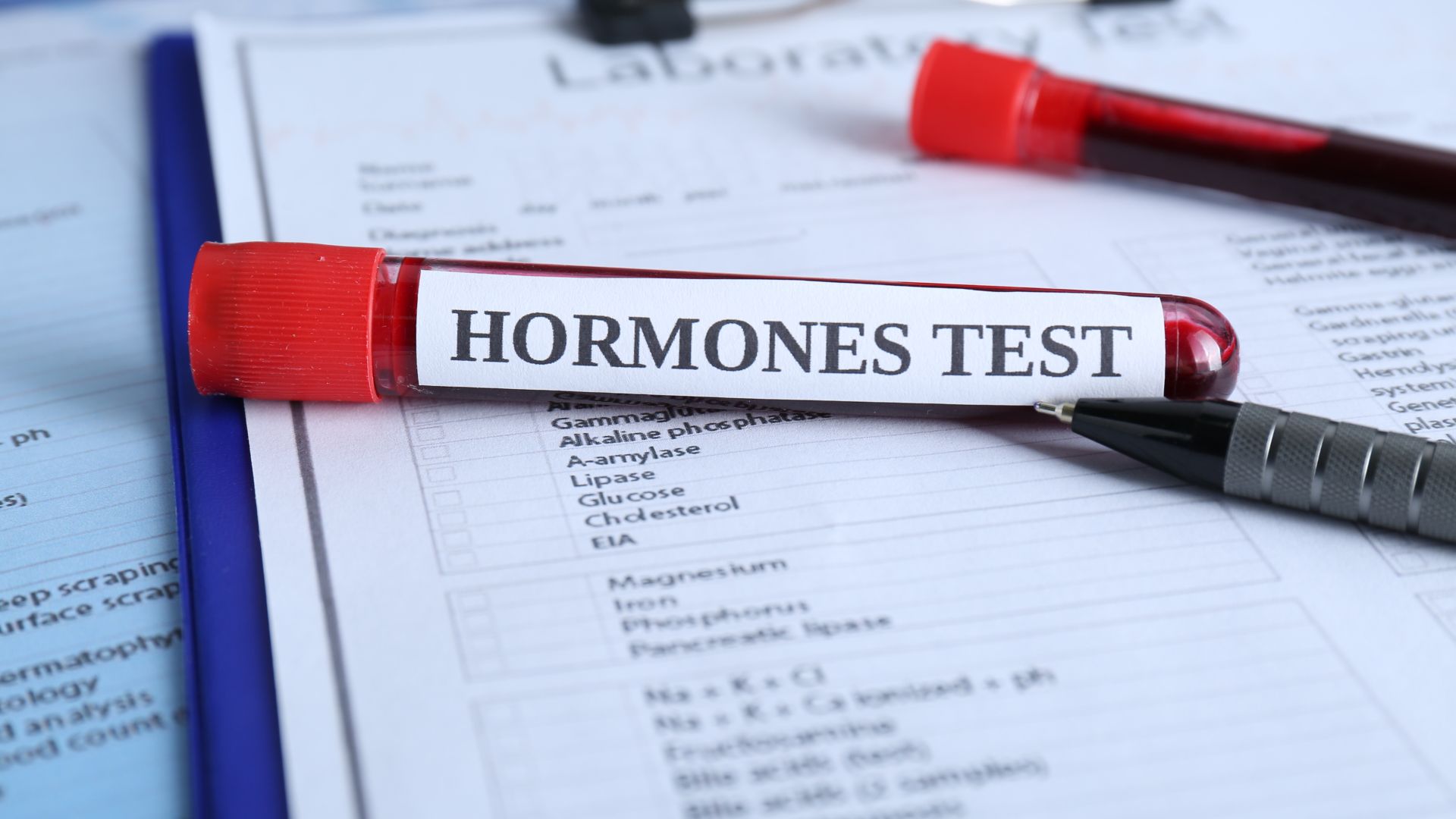 Hormones Test