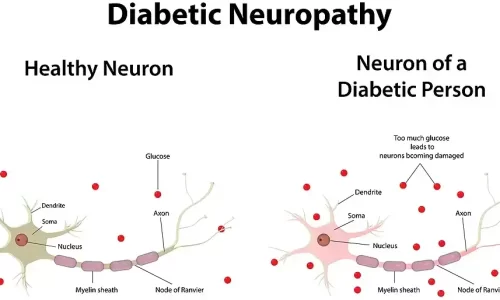 Diabetic Neuropathy