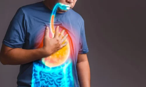 Gastroesophageal Reflux Disease (GERD), H.Pylori, Heartburn