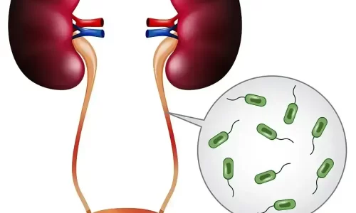 Urinary Tract Infections (UTI) Symptoms